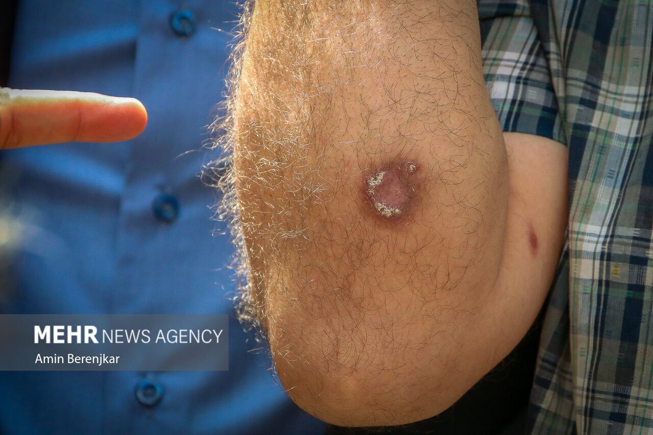 تصاویر | هشدار به شیرازی ها؛ جولان «سالَک» در محله «سنگ سیاه»