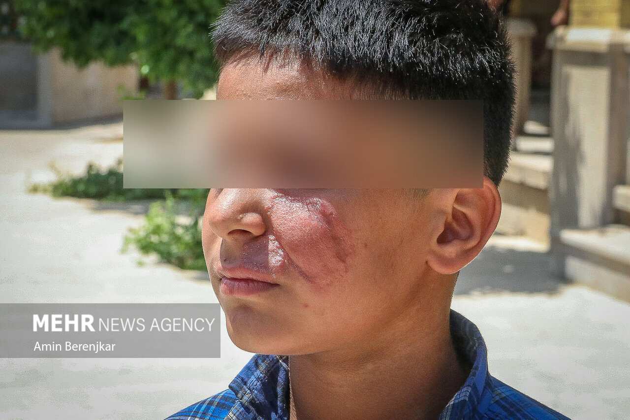 تصاویر | هشدار به شیرازی ها؛ جولان «سالَک» در محله «سنگ سیاه»