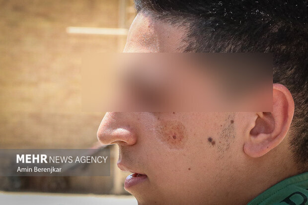 تصاویر | هشدار به شیرازی ها؛ جولان «سالَک» در محله «سنگ سیاه»