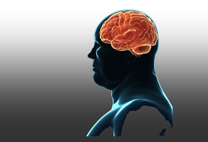 چاقی مغز را تغییر میدهد| تغییرات مغزی علت مشکل بودن کم کردن وزن است brain