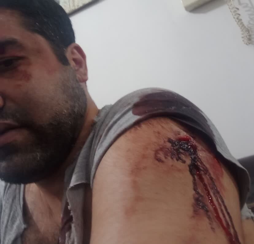 تصاویر چاقو خوردن یک استاد دانشگاه به خاطر حمایت از ۲ زن! | مزاحمت ۲ پسر با حالت غیرعادی برای ۲ خانم در اندیشه کرج