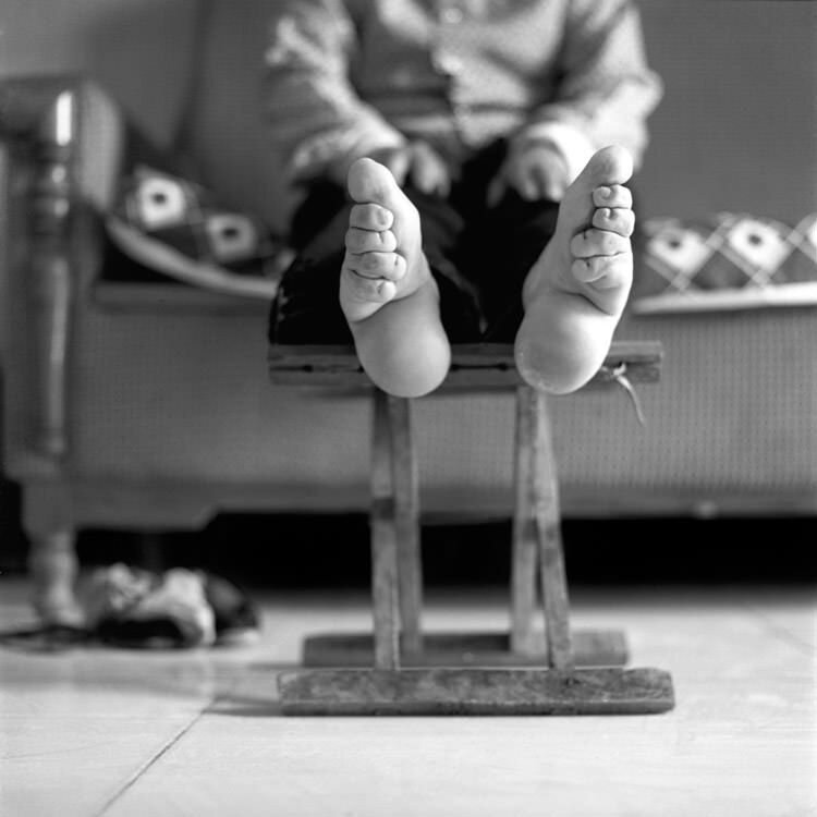 رسم عجیب کوچک کردن پای زنان ؛ زنانی با کوچک‌ترین پاهای دنیا!