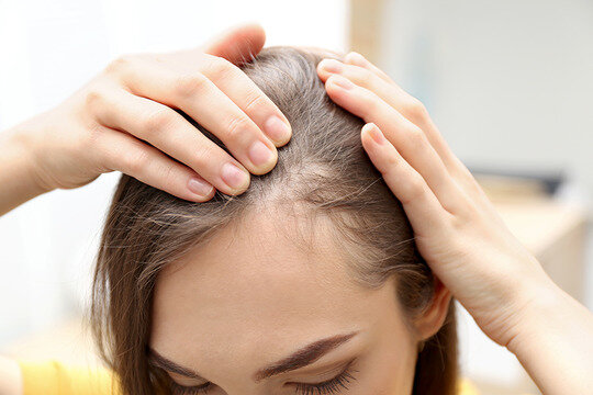 هر آنچه باید در مورد ریزش مو بدانید | روش‌های جدید برای درمان ریزش مو