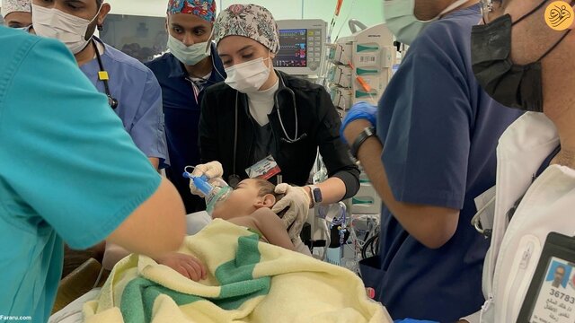 جداسازی دوقلوهای بههم چسبیده