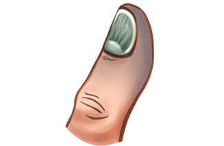 هشت علامت در دست و ناخنها که نشانه از بیماری شماست