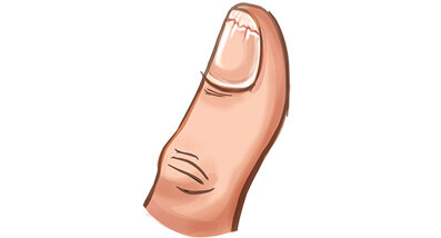 هشت علامت در دست و ناخنها که نشانه از بیماری شماست