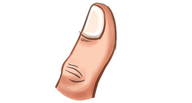 هشت علامت در دست و ناخنها که نشانه از بیماری شماست