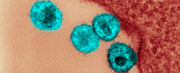 «بیمار ژنو» نخستین مبتلا به اچ‌آی‌وی که پس از پیوند سلول بنیادی «طبیعی» عفونتش فروکش کرد