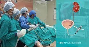 جدیدترین متد جراحی سنگ کلیه| خبر خوب و امیدوار کننده برای کلیههای سنگ ساز| کاهش عملکرد کلیه با هر بار دفع سنگ