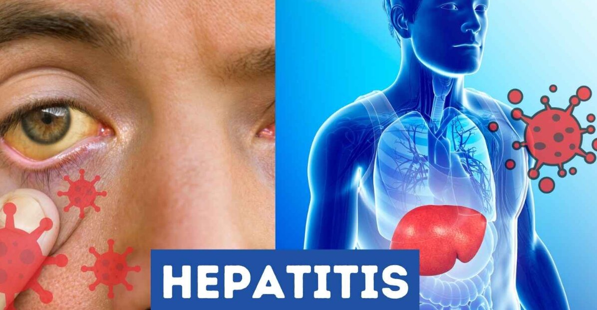 روز جهانی هپاتیت؛ فرصتی برای توجه بیشتر به بیماری هپاتیت؛ پیشگیری و درمان | چه کسانی بیشتر در معرض خطر ابتلا به هپاتیت هستند