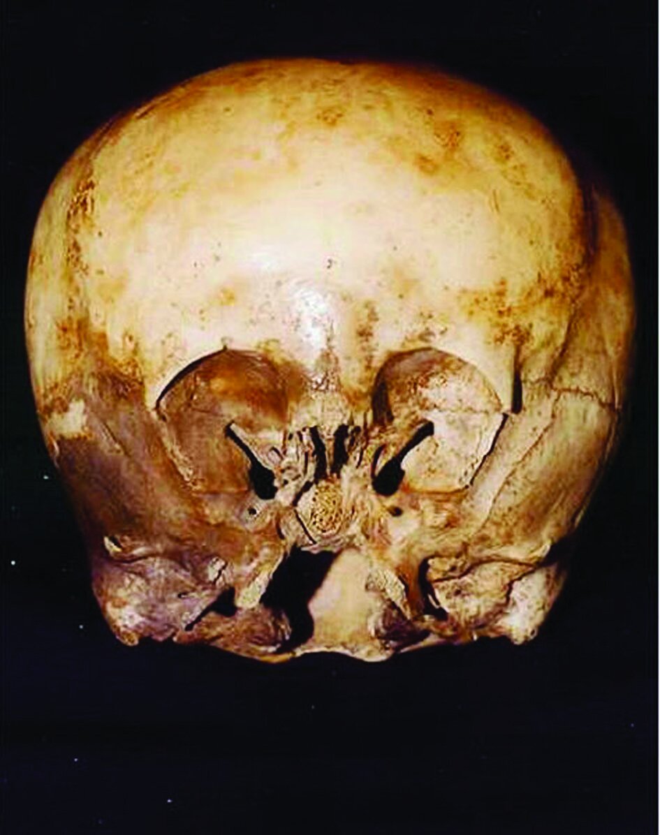 راز های پنهان جمجمه ها و استخوان‌های کشف شده توسط باستان شناسان
