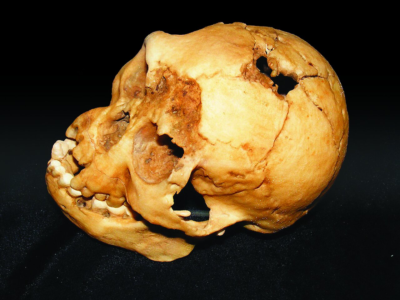 راز های پنهان جمجمه ها و استخوانهای کشف شده توسط باستان شناسان