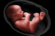 اصل ماجرا|غربالگری جنین با رعایت استانداردها ممنوع نیست
