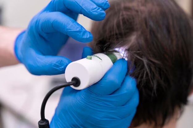 عوارض لیزر موهای زائد | نکات مهم درباره لیزر و کاربردهای آن که باید بدانیم
