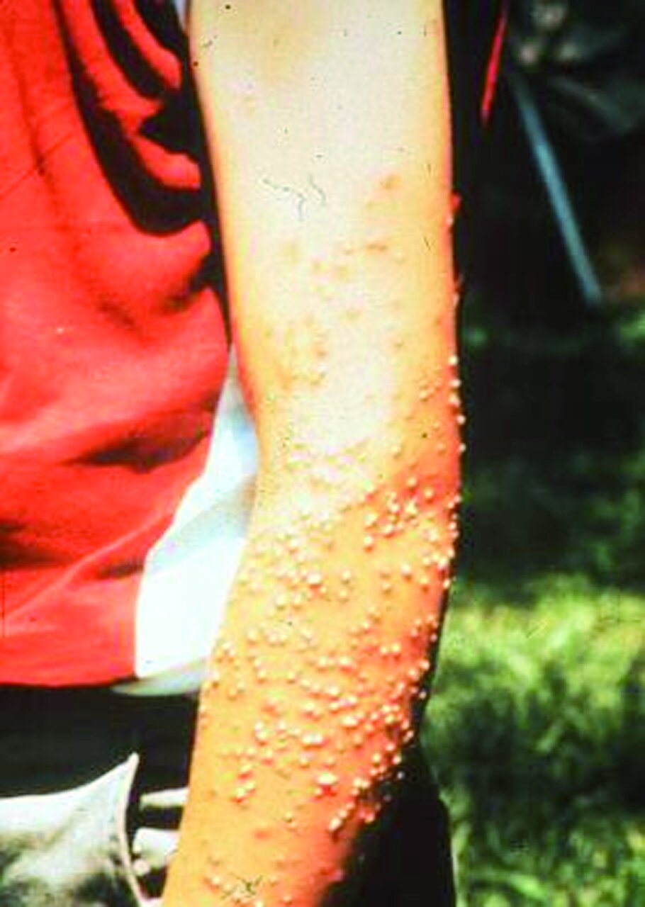 مرگبارترین حشرات جهان ؛ اگر نزدیک این حشرات شوید سرنوشتتان مرگ است