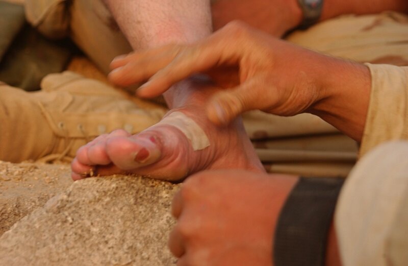 جلوگیری از تاول زدن پا در کفش با این راهکارهای ساده | برای درمان تاول‌های ایجاد شده چه کنیم؟