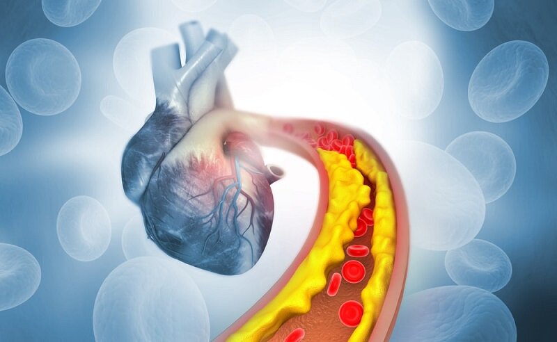 نشانه های بیماری قلبی چیست ؟ | ۴ توصیه مفید برای سلامت قلب