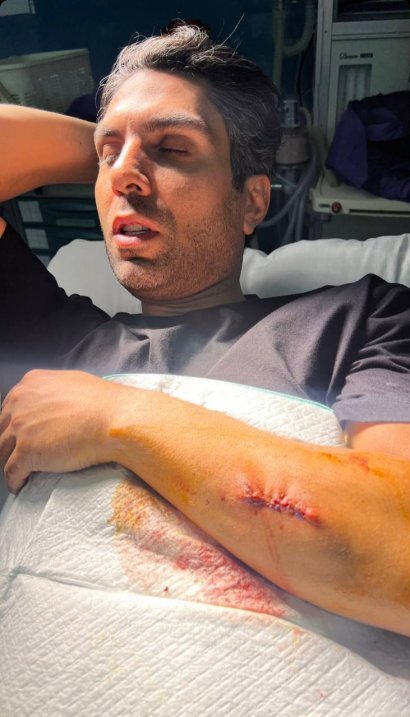 تصاویر | حمله خونین سارقان به یک پرسپولیسی | تصاویر آسیب دیدگی شدید چهره مطرح پرسپولیسیها