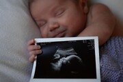 وزیر بهداشت واقعا مادران باردار را تهدید کرد؟ | واقعیت ماجرای رصد بارداری ؛ پاسخ به چند شبهه درباره غربالگری جنین