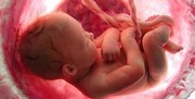 ۴ عاملی که منجر به مرگ جنین در رحم مادر می‌شود | این مادران دیگر باردار نمی‌شوند؟ | سالانه ۶۵ هزار جنین خودبه‌خود سقط می‌شوند