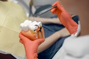 عوارض دندان خراب ؛ پوسیدگی دندان چه بلایی سر بقیه اعضای بدن می‌آورد؟