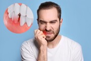 راز دندان سالم ؛ ۱۰ نکته درباره رعایت بهداشت دندان | چه کار کنیم تا دندان های سالمی داشته باشیم؟