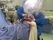 شاهکار پزشکان ایرانی این‌بار در یزد | تصاویر ۱۶+ خارج کردن تومور ۳.۵ کیلویی از سر دختربچه | جراحی پیچیده‌ای که آلمان هم نتوانست انجام دهد