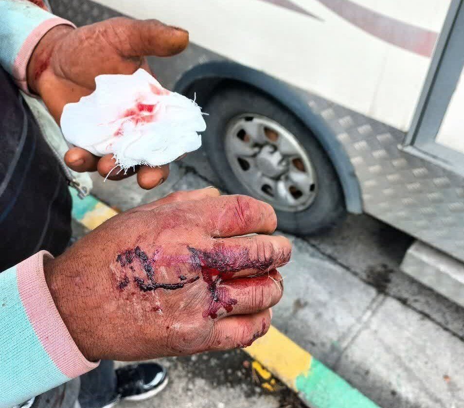 تصاویر هولناک حمله سگ‌های ولگرد به یک خانواده در فردیس | سگ‌ها خون به پا کردند!