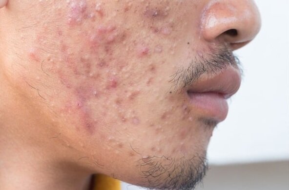 معجزه آب برنج ؛ بهترین ماده طبیعی برای شادابی پوست و رشد مو