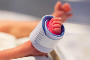 نوزادان کم‌وزن هنگام تولد بیشتر در معرض خطر کبد چرب در بزرگسالی هستند