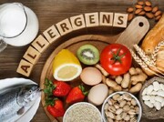 آلرژی غذایی چیست؟ | ۸ غذای حساسیت‌زا را بشناسید | بهترین راه تشخیص آلرژی غذایی