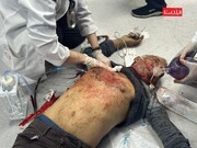 ببینید | روایت خبرنگار الجزیره از شب هولناک  بیمارستان غزه | به سختی یک بدن کامل با تمام اعضایش در بیمارستان پیدا می‌شد