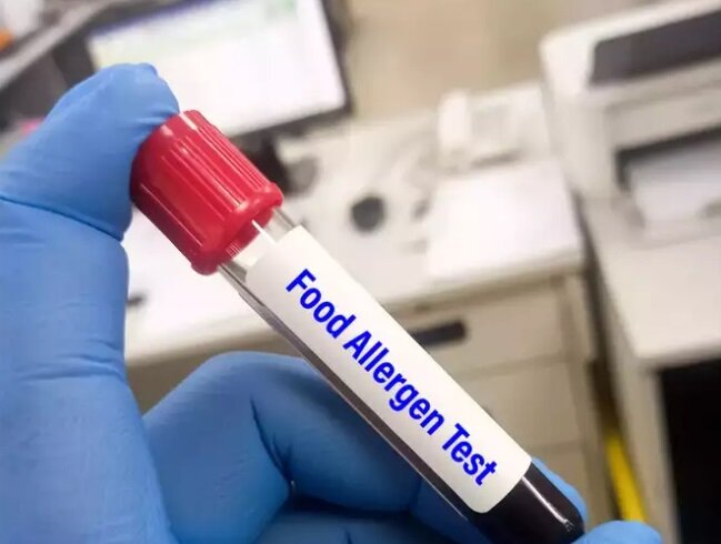 آلرژی غذایی چیست؟ | ۸ غذای حساسیتزا را بشناسید | بهترین راه تشخیص آلرژی غذایی