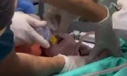 تصاویر مادر مجروحی که مجبور به زایمان شد؛ پزشکان در حال نجات نوزادند