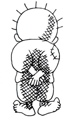 حنظله زنده می ماند