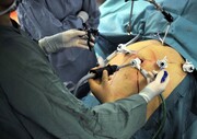 عوارض خطرناک بوتاکس معده برای لاغری ؛ جراحی چاقی رایگان برای این افراد | کدام پزشکان صلاحیت جراحی‌های چاقی را دارند؟