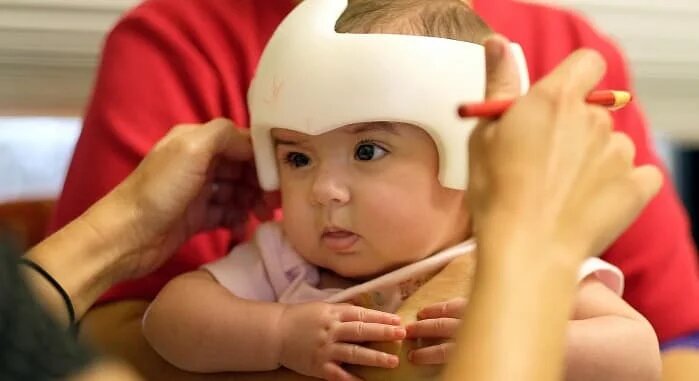 شناسایی ۱۰ بیماری که تاکنون در ایران نبوده | مشاورههای ژنتیک را جدی بگیرید | ایران جزو کشورهای با شیوع بالای بیماریهای نادر