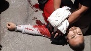(عکس ۱۸+) حمله خونین مزاحمین نوامیس به یک آتش‌نشان در تهران + جزئیات