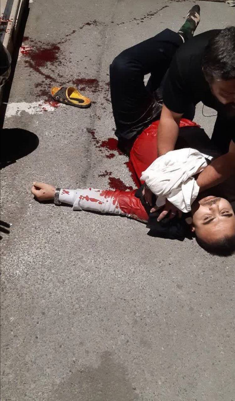 (عکس ۱۸+) حمله خونین مزاحمین نوامیس به یک آتشنشان در تهران + جزئیات