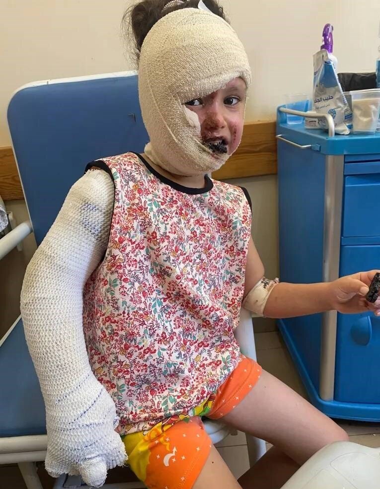 یک گزارش تکان دهنده؛ از ذوب شدن استخوان قربانیان تا پیکرهای متلاشی شده | استفاده اسرائیل از مواد شیمیایی خاص آمریکایی برای نخستین بار