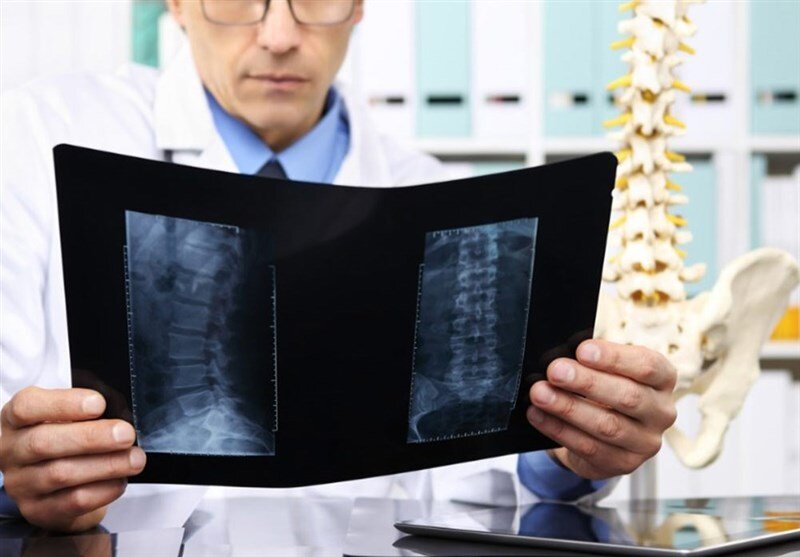 ۲ ماده غذایی که استخوانها را محکم میکنند