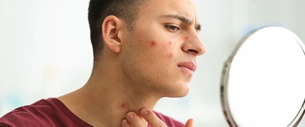 فواید کمتر شناخته شده روغن بادام زمینی ؛ از حفظ سلامت قلب تا کاهش درد آتروز