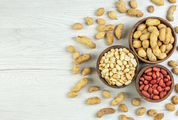 آلرژی را چگونه درمان کنیم؟ | نسخههای اشتباه بلای جان مبتلایان به آلرژی | پرهیز غذایی را کنار بگذاریم؟