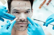 افزایش جراحی زیبایی در مردان | ۳۰ درصد مراجعه‌کنندگان به عمل زیبایی نیازی ندارند | توصیه‌های مهم به مشتریان جراحی زیبایی