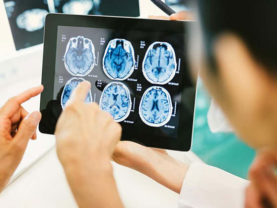 راهکاری ساده برای سلامت مغز که محققان را متعجب کرد