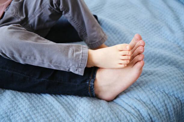 اهمیت قوس کف پا ؛ کف پای صاف درمان دارد؟ | چرا کف پا صاف میشود و چه مشکلاتی به همراه خواهد داشت؟