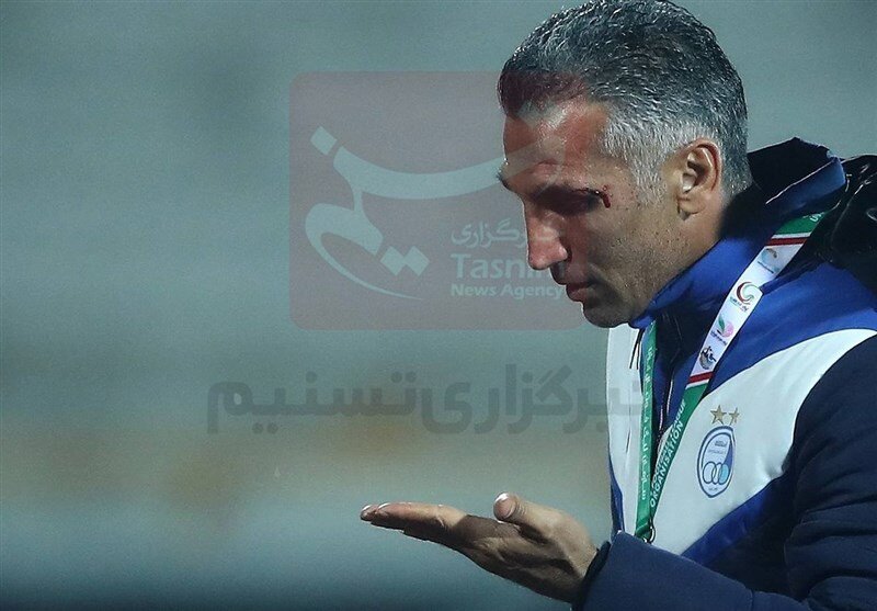 واضح ترین تصویر از صورت خونی مهدی هاشمی نسب