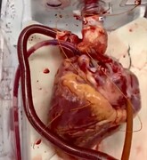 تصاویر قلب در حال تپش در خارج از بدن | عملکرد این قلب آماده پیوند را ببینید