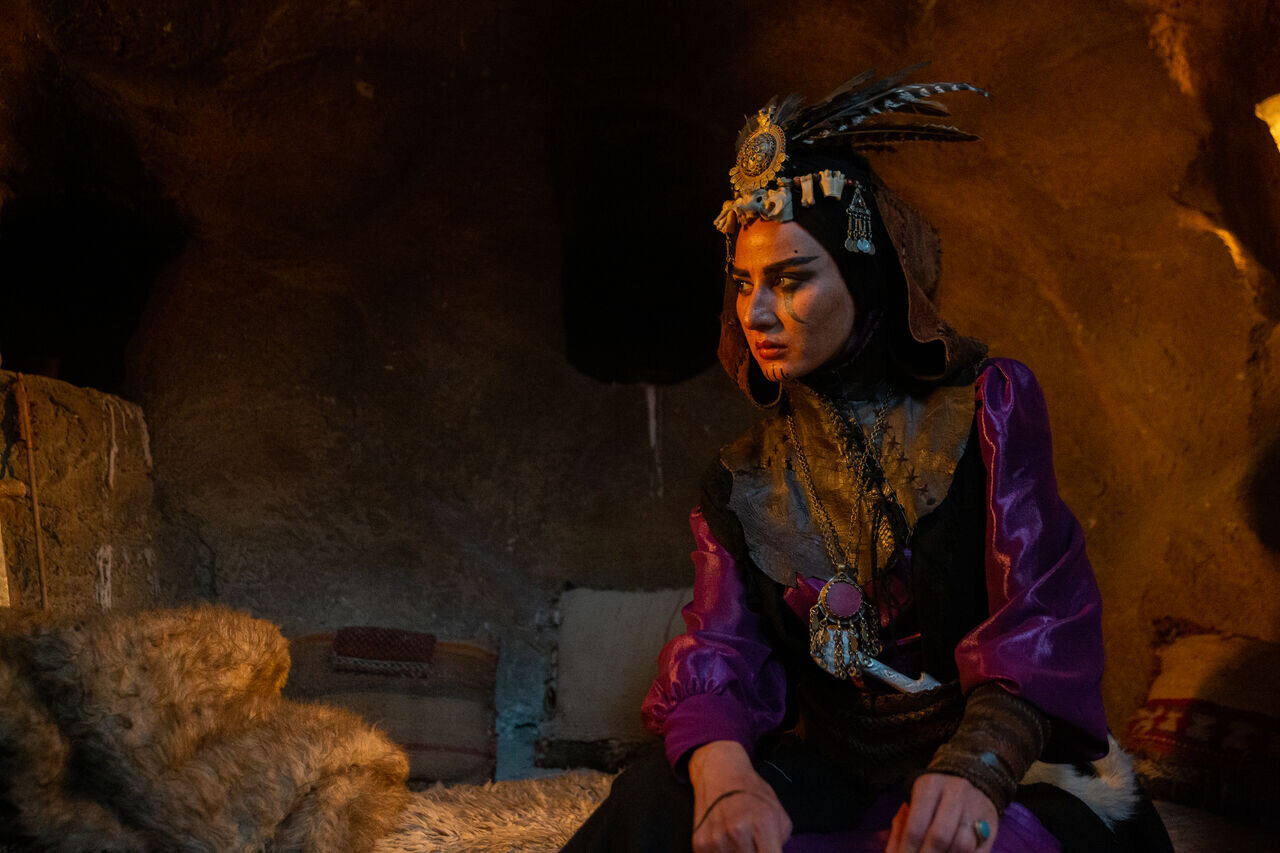 عفونت چشمی بازیگر سریال مستوران | لنز در چشم من فاسد شده بود