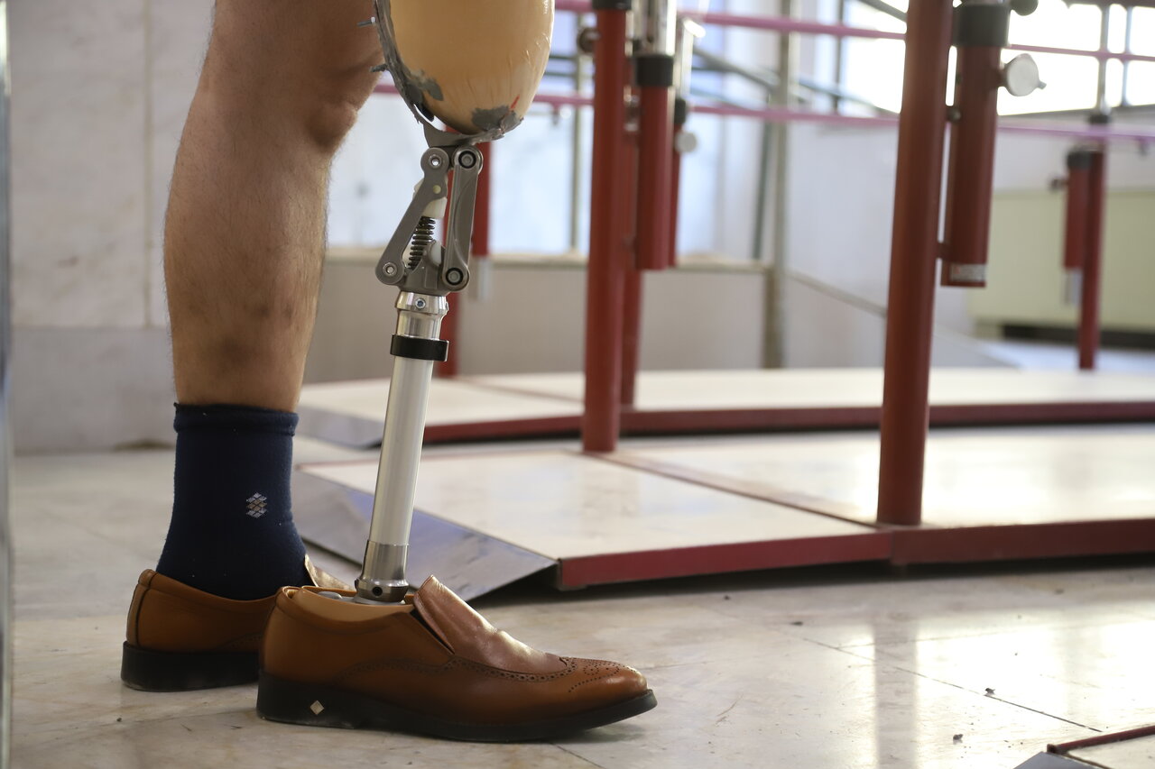 اینجا کارخانه دست و پا سازی است | تصاویر